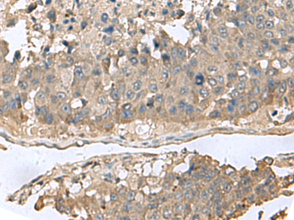 Rabbit Polyclonal Antibody to GABARAPL2