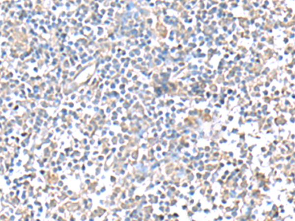 Rabbit Polyclonal Antibody to IFI27