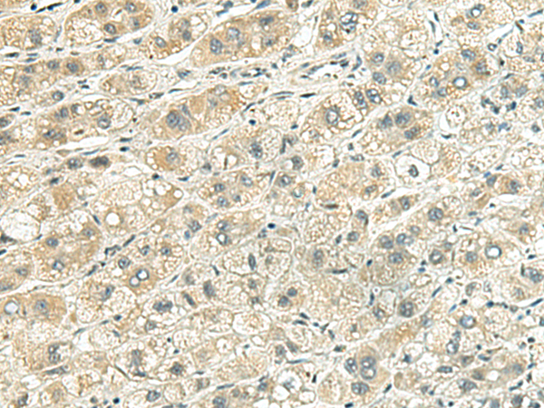 Rabbit Polyclonal Antibody to RHBDL2
