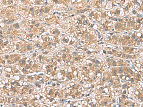 Rabbit Polyclonal Antibody to PHLDA3