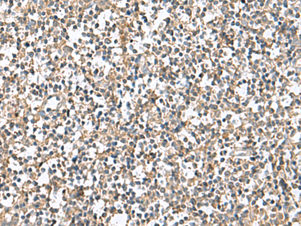 Rabbit Polyclonal Antibody to PTPRS