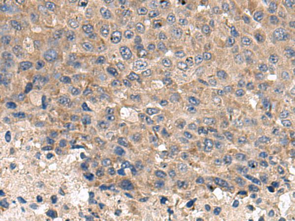 Rabbit Polyclonal Antibody to CD59
