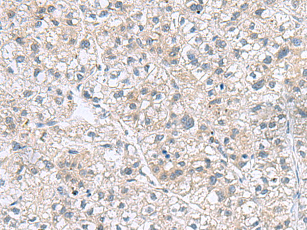 Rabbit Polyclonal Antibody to GEMIN7