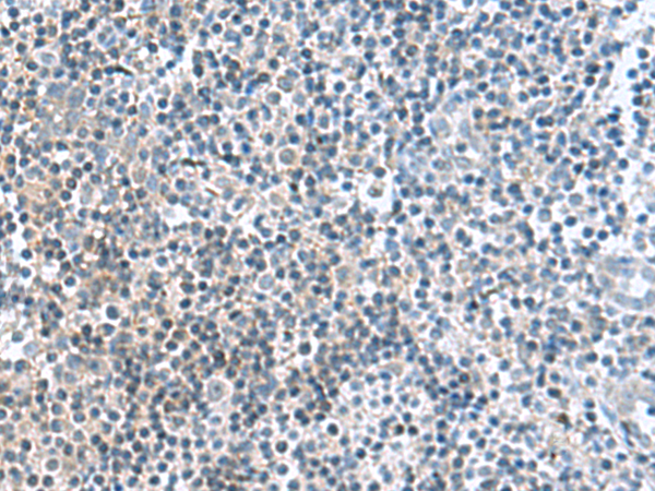 Rabbit Polyclonal Antibody to FAM107B