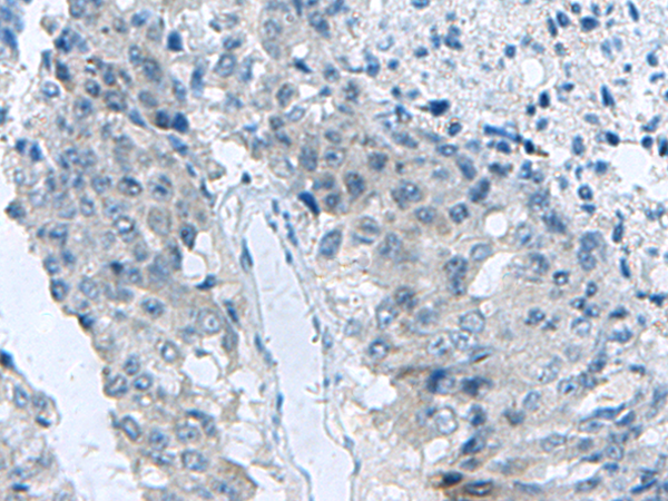 Rabbit Polyclonal Antibody to MED31