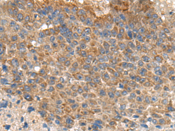 Rabbit Polyclonal Antibody to MIA