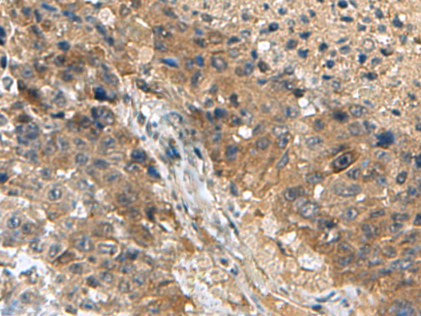 Rabbit Polyclonal Antibody to TPD52L3