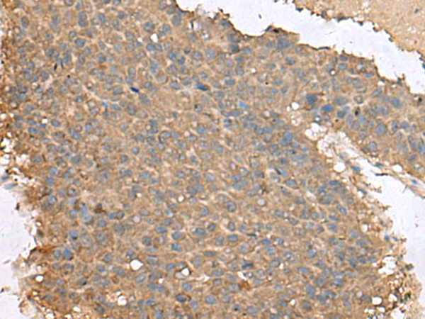 Rabbit Polyclonal Antibody to TAFA4