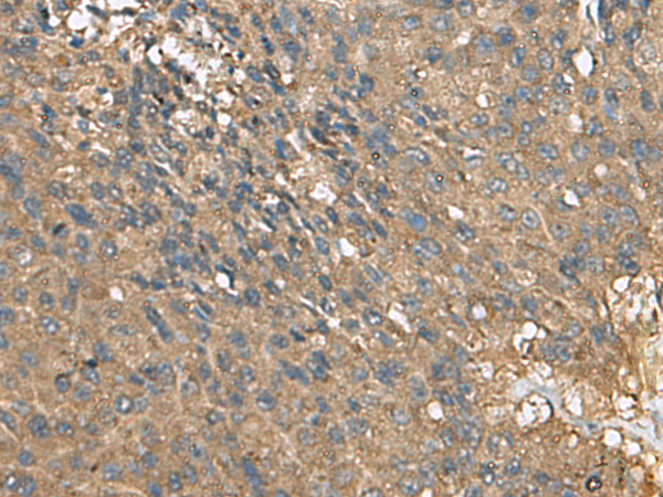 Rabbit Polyclonal Antibody to EIF1AX