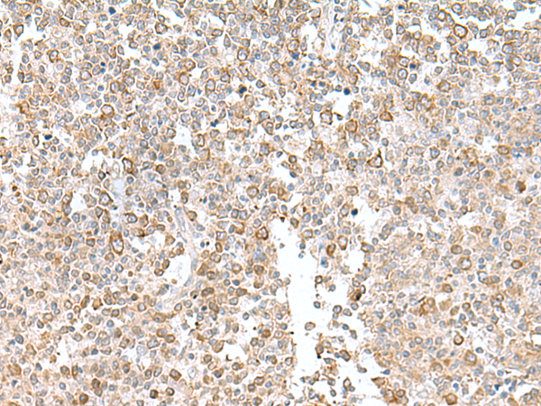 Rabbit Polyclonal Antibody to EIF1AY