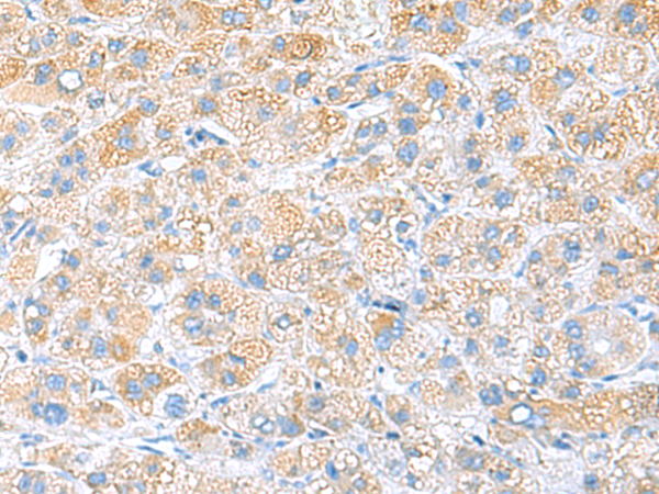 Rabbit Polyclonal Antibody to RPS16