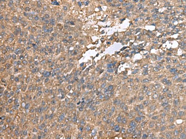 Rabbit Polyclonal Antibody to AHNAK