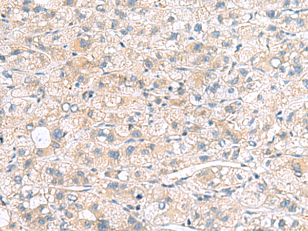 Rabbit Polyclonal Antibody to MYL1