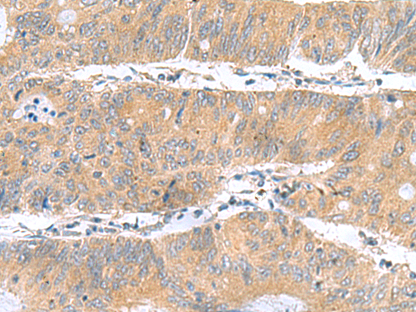 Rabbit Polyclonal Antibody to DNAL1