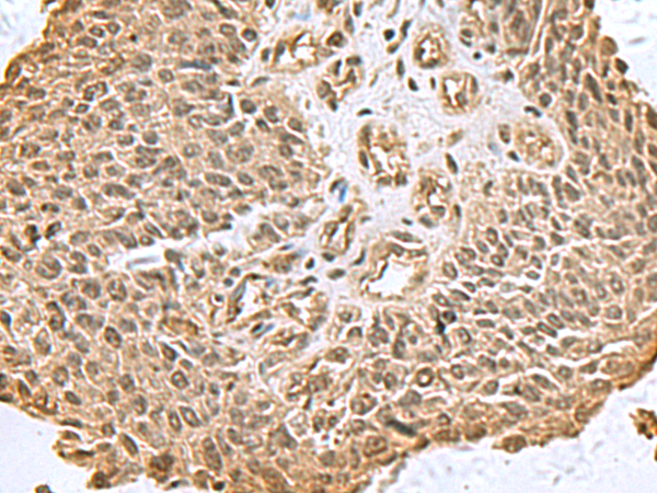 Rabbit Polyclonal Antibody to DCTPP1
