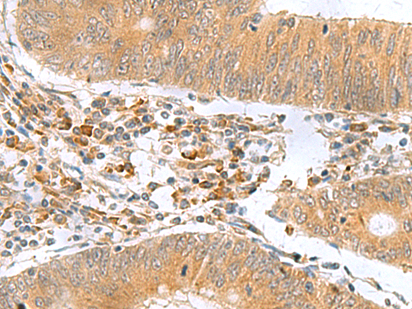 Rabbit Polyclonal Antibody to MYDGF