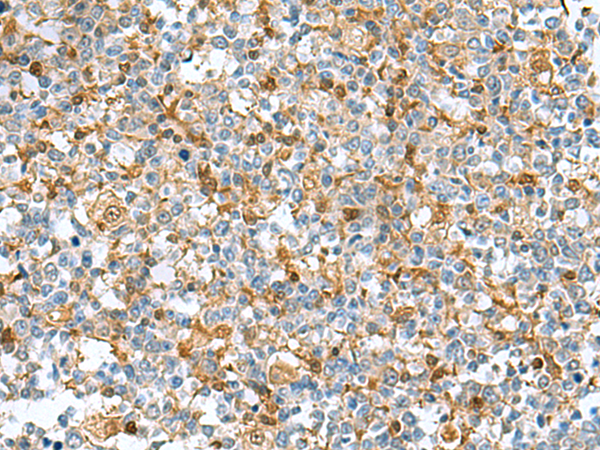 Rabbit Polyclonal Antibody to DNPH1