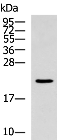 Rabbit Polyclonal Antibody to NMU