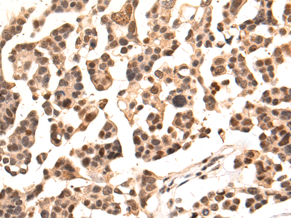 Rabbit Polyclonal Antibody to MED30