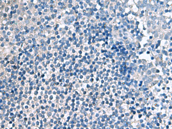 Rabbit Polyclonal Antibody to EIF4A2