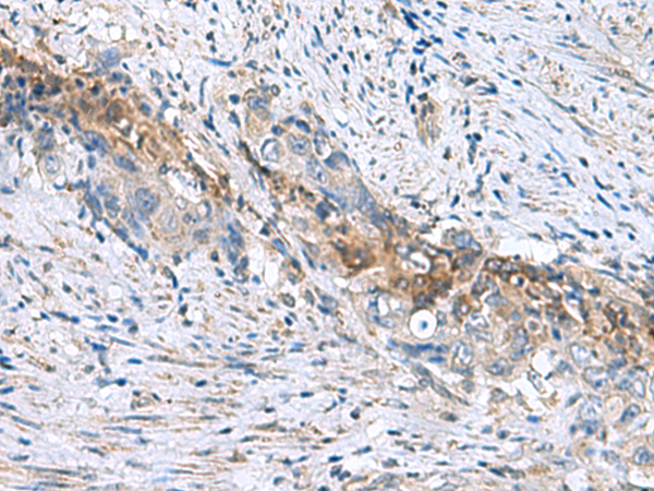 Rabbit Polyclonal Antibody to RNF208