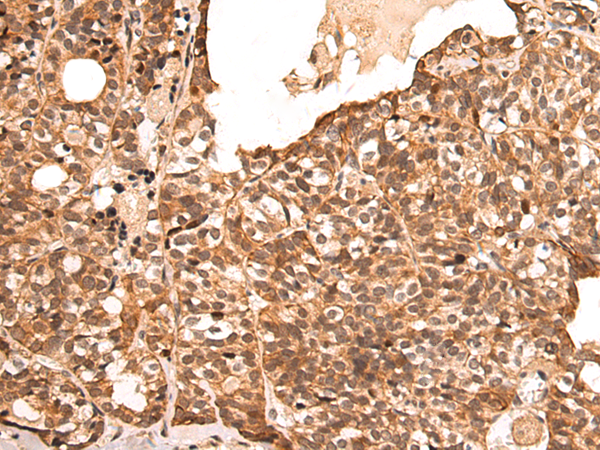 Rabbit Polyclonal Antibody to SAP30L