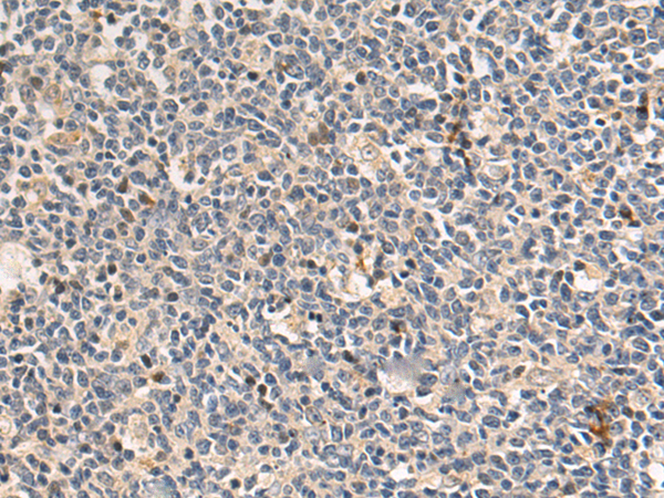 Rabbit Polyclonal Antibody to MFAP2