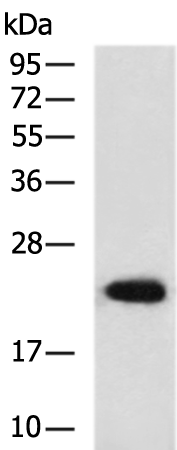 Rabbit Polyclonal Antibody to TNNI1