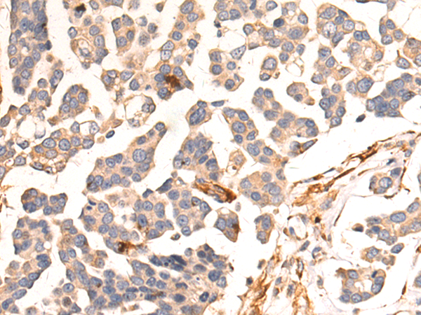 Rabbit Polyclonal Antibody to CENPBD1