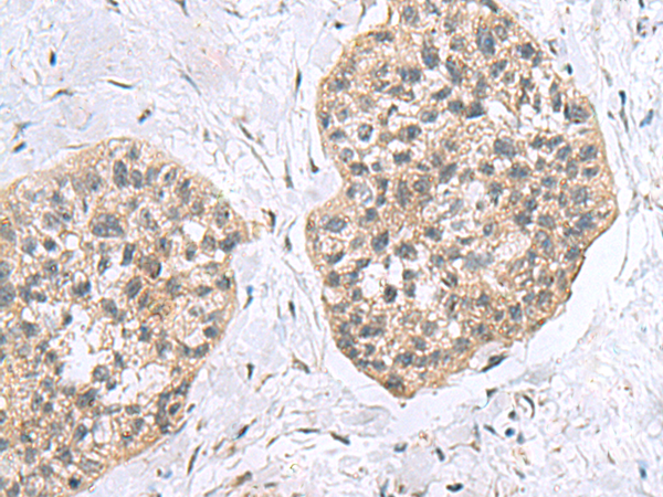 Rabbit Polyclonal Antibody to RPL18
