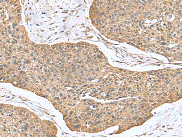 Rabbit Polyclonal Antibody to CSRP2