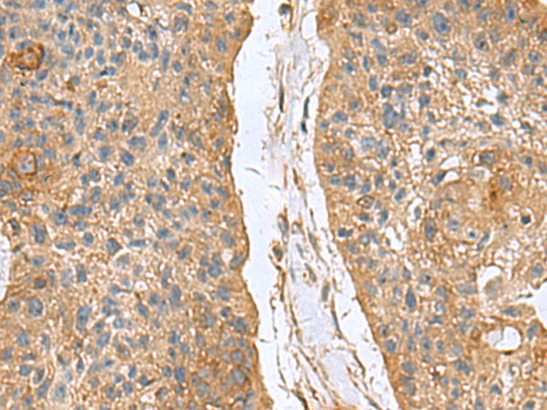 Rabbit Polyclonal Antibody to MARCKSL1