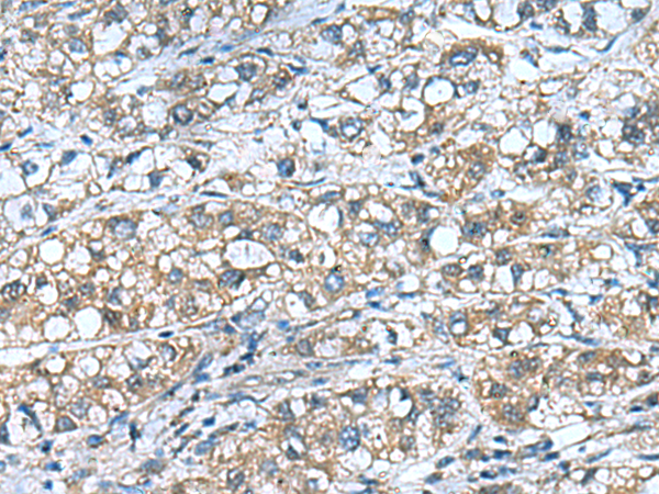 Rabbit Polyclonal Antibody to COMMD9