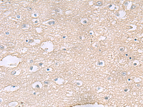 Rabbit Polyclonal Antibody to TAGLN3