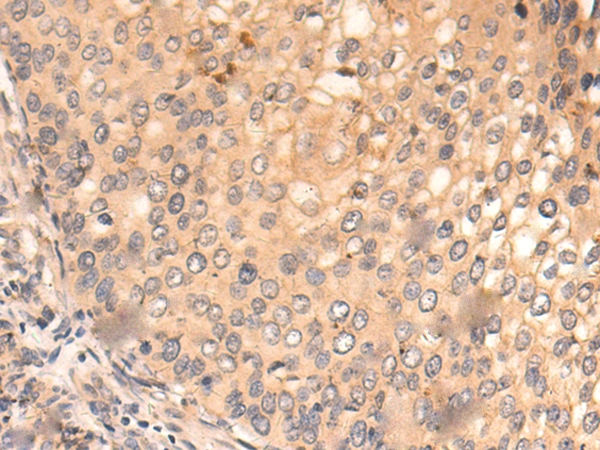 Rabbit Polyclonal Antibody to RAB10