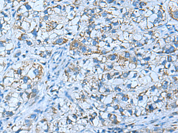 Rabbit Polyclonal Antibody to GUCA1A
