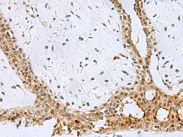 Rabbit Polyclonal Antibody to BCL7B