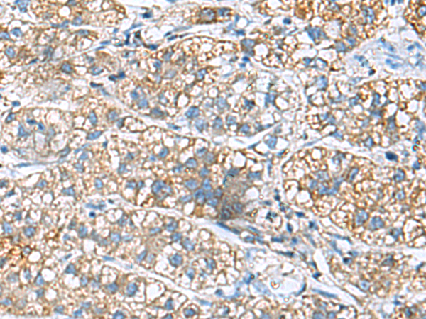 Rabbit Polyclonal Antibody to JOSD1