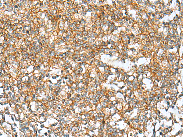 Rabbit Polyclonal Antibody to RAB13