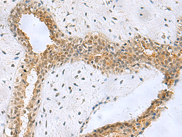Rabbit Polyclonal Antibody to NABP1