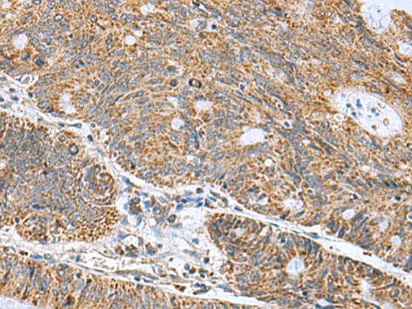 Rabbit Polyclonal Antibody to MRPL40