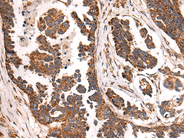 Rabbit Polyclonal Antibody to MRPL58