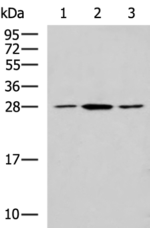 Rabbit Polyclonal Antibody to CLTB
