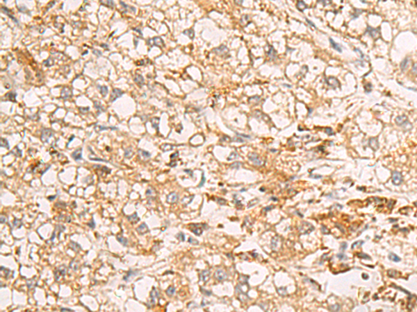 Rabbit Polyclonal Antibody to RAB38