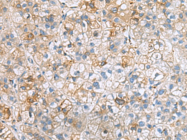 Rabbit Polyclonal Antibody to IGLL1
