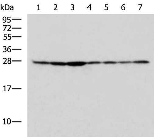 Rabbit Polyclonal Antibody to RPL10A