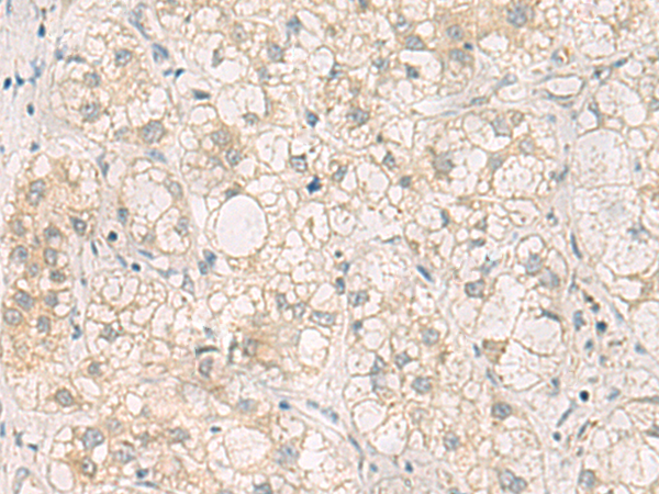 Rabbit Polyclonal Antibody to LRAT