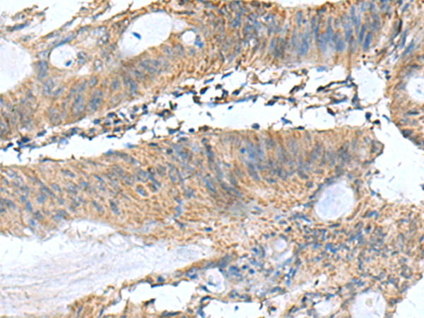 Rabbit Polyclonal Antibody to PAFAH1B3