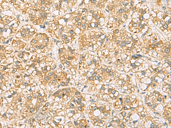 Rabbit Polyclonal Antibody to FAAP100