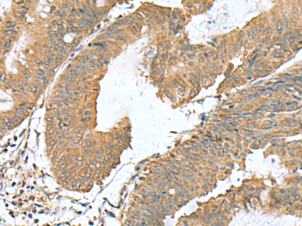 Rabbit Polyclonal Antibody to RAB23